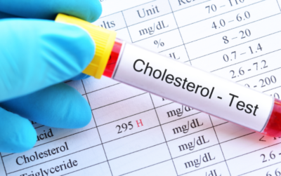 Cholesterol Tests